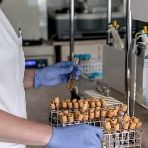 Hormone Testing at Global Integrative Medicine, Naturopathic Doctor's Office